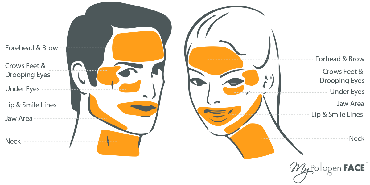 s2